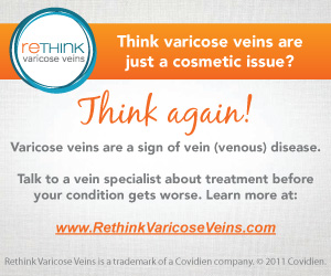 rethink varicose veins