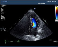 Patient Education – Utah Cardiology